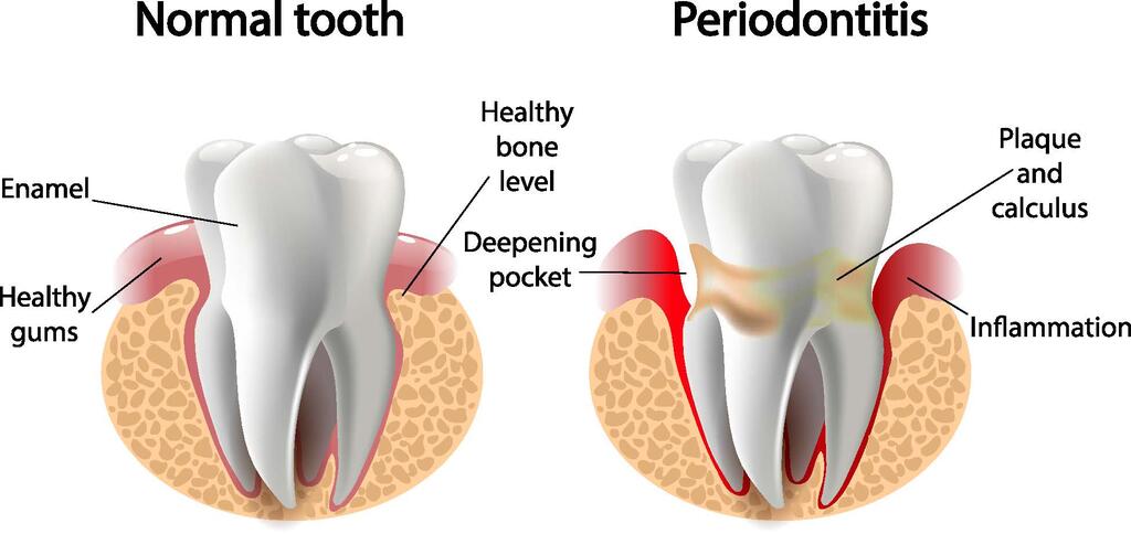 periodontal johor bahru