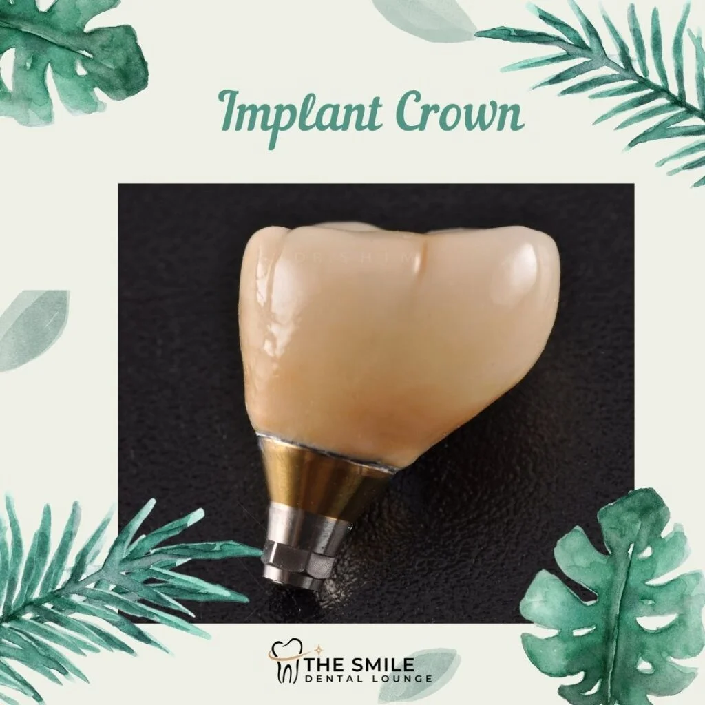 Implant crown