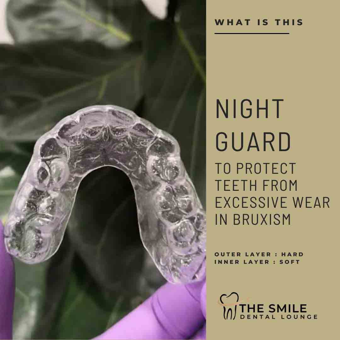 An Effective Mouth Guard for Snoring Solutions