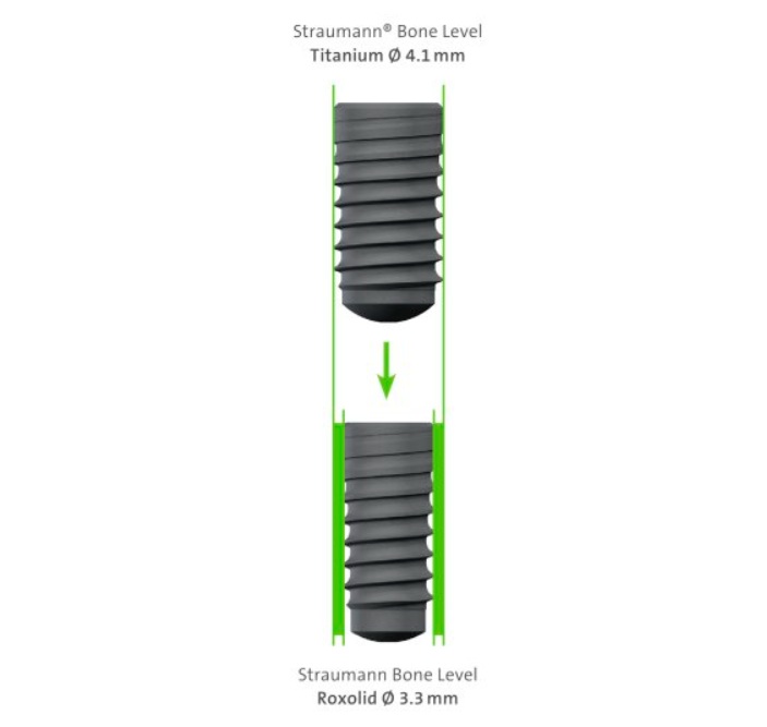 Roxolid dental implant